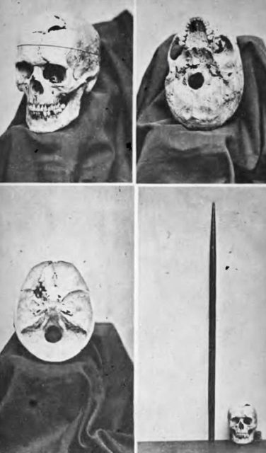 phineas-gage-history-s-great-brain-injury-survivor-professional-moron