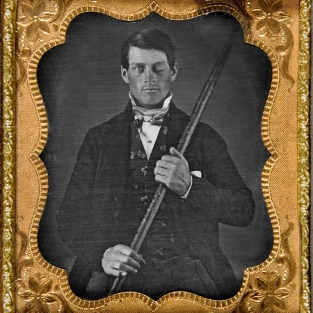 Phineas Gage and the iron rod