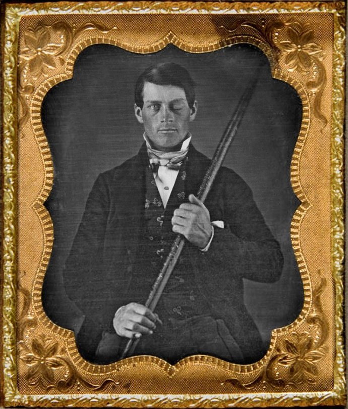 Phineas Gage and the iron rod
