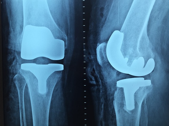 Kneecaps after an X ray