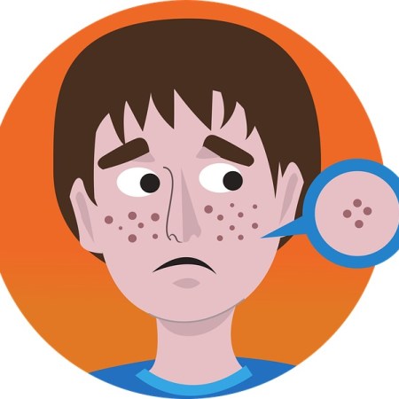 A boy with acne